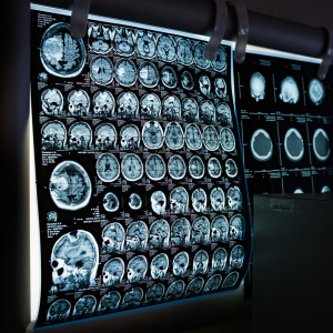 Technologue en imagerie médicale (radiodiagnostic)